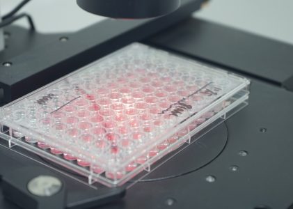 养好RAW264.7，别让它“想太多”