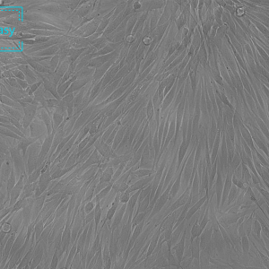 人卵巢颗粒细胞瘤细胞