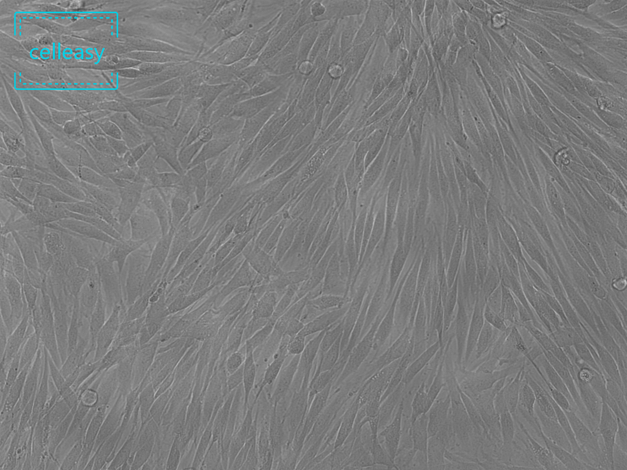 人卵巢颗粒细胞瘤细胞