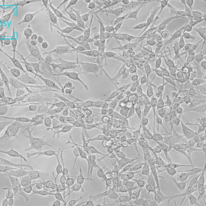 小鼠肺腺癌细胞