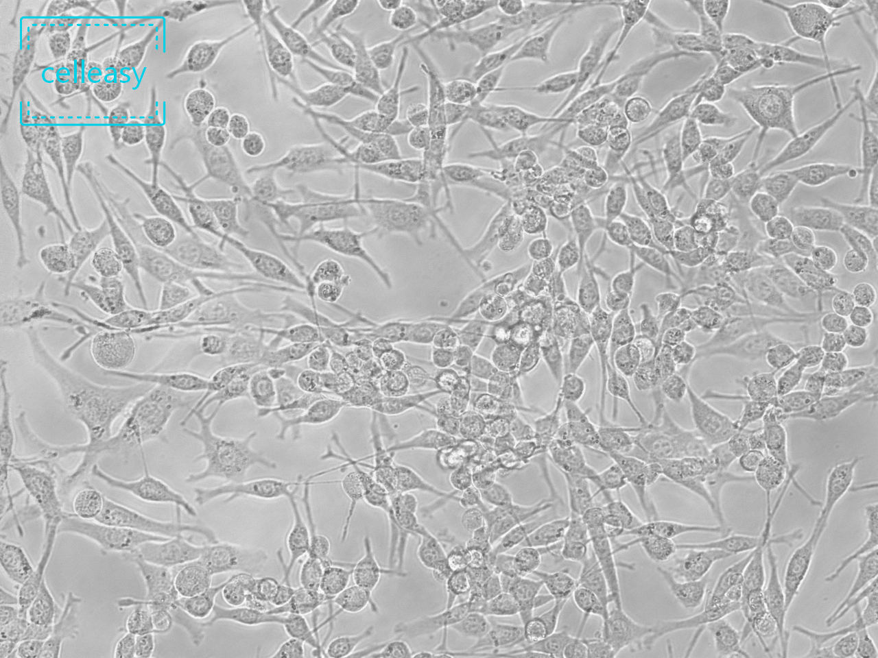 小鼠肺腺癌细胞