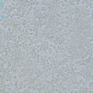 小鼠Lewis肺癌细胞