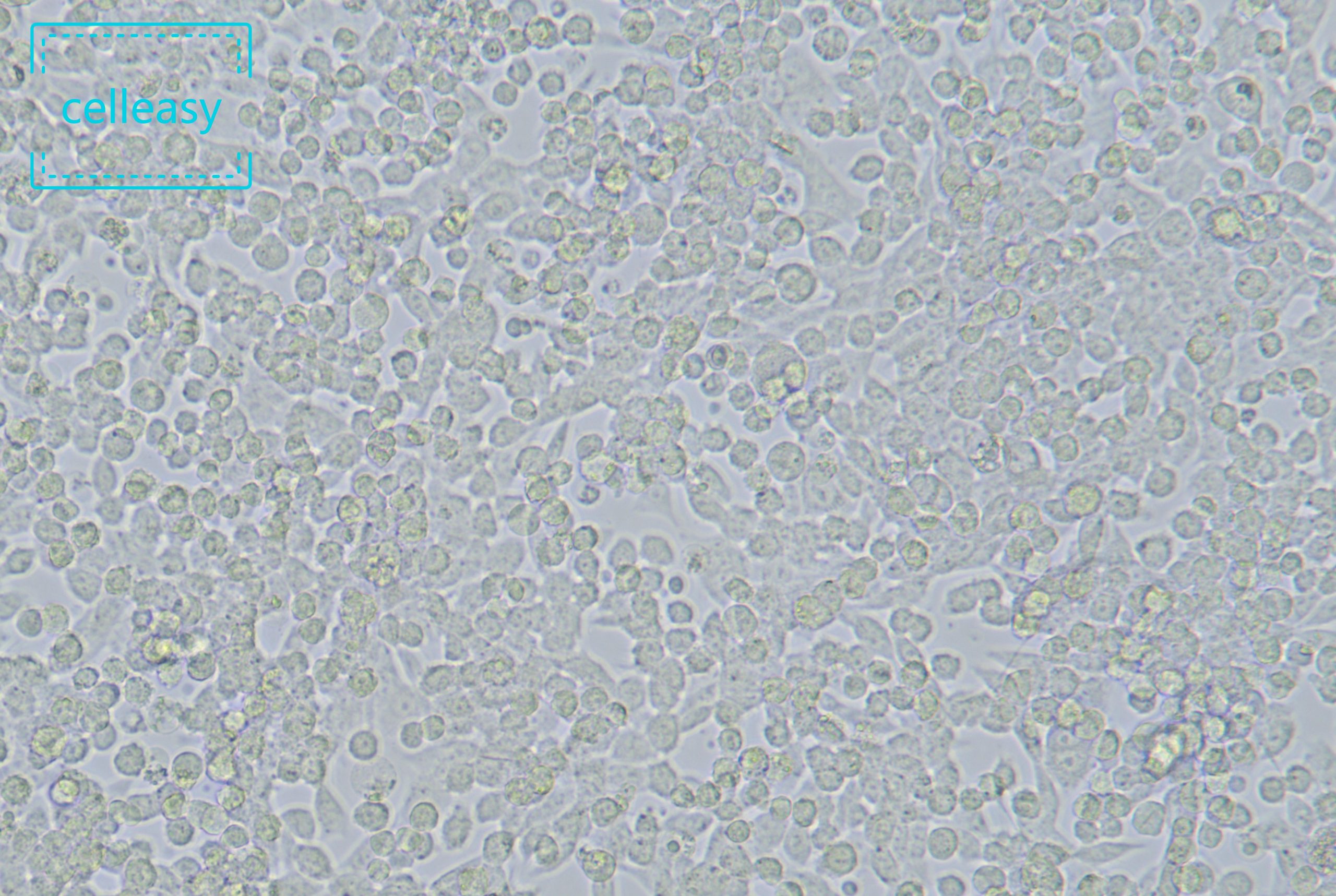 小鼠Lewis肺癌细胞