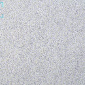 人前列腺癌细胞