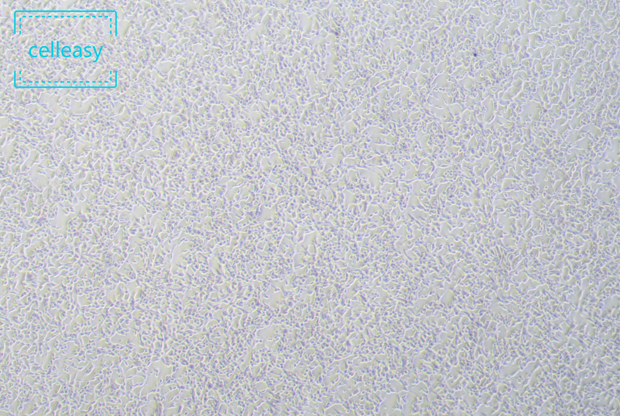 人前列腺癌细胞