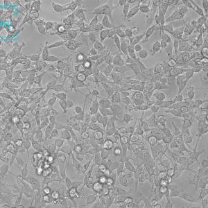 小鼠结肠癌细胞