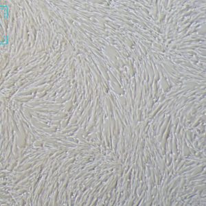 人胚肺成纤维细胞