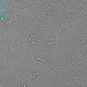 小鼠单核巨噬细胞白血病细胞