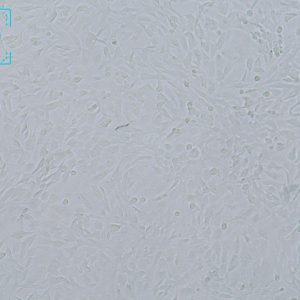 人神经母细胞瘤细胞