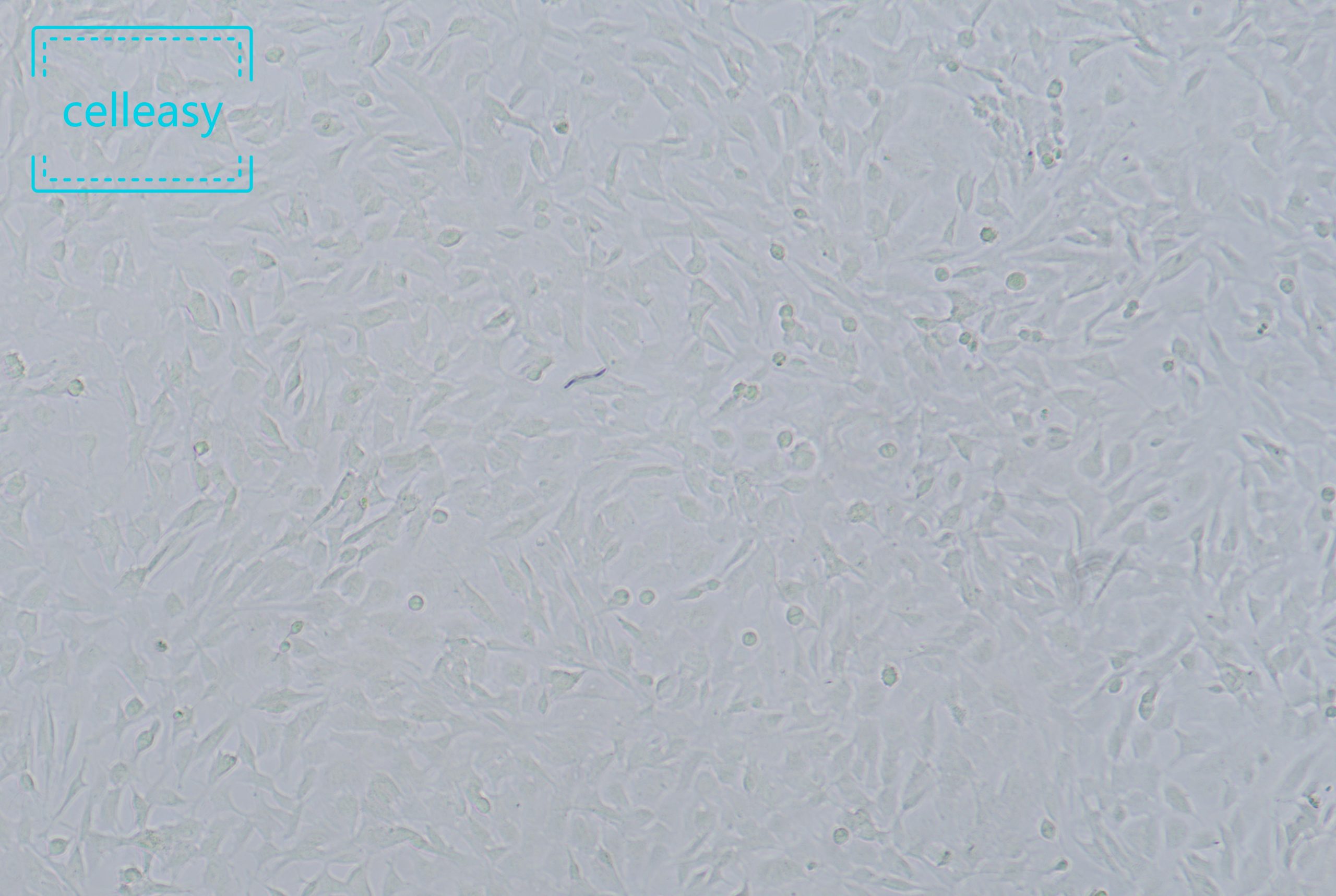 人神经母细胞瘤细胞