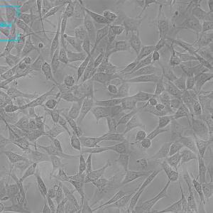 人支气管上皮细胞