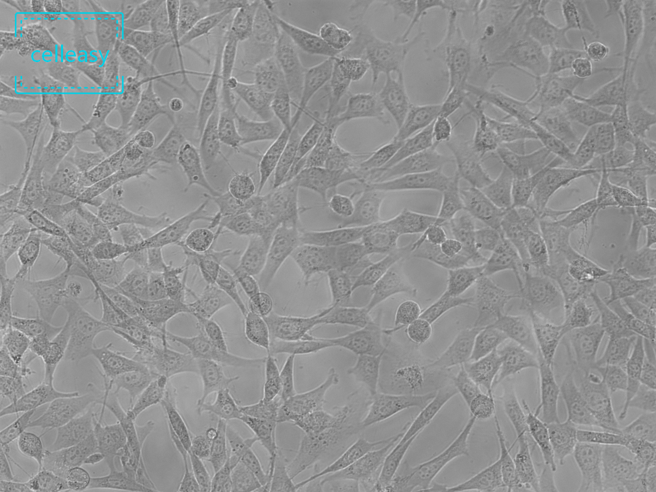 人支气管上皮细胞