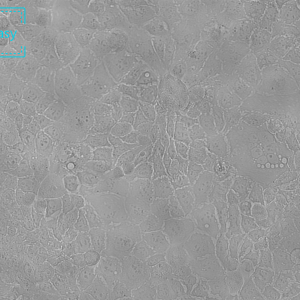 人结肠腺癌细胞