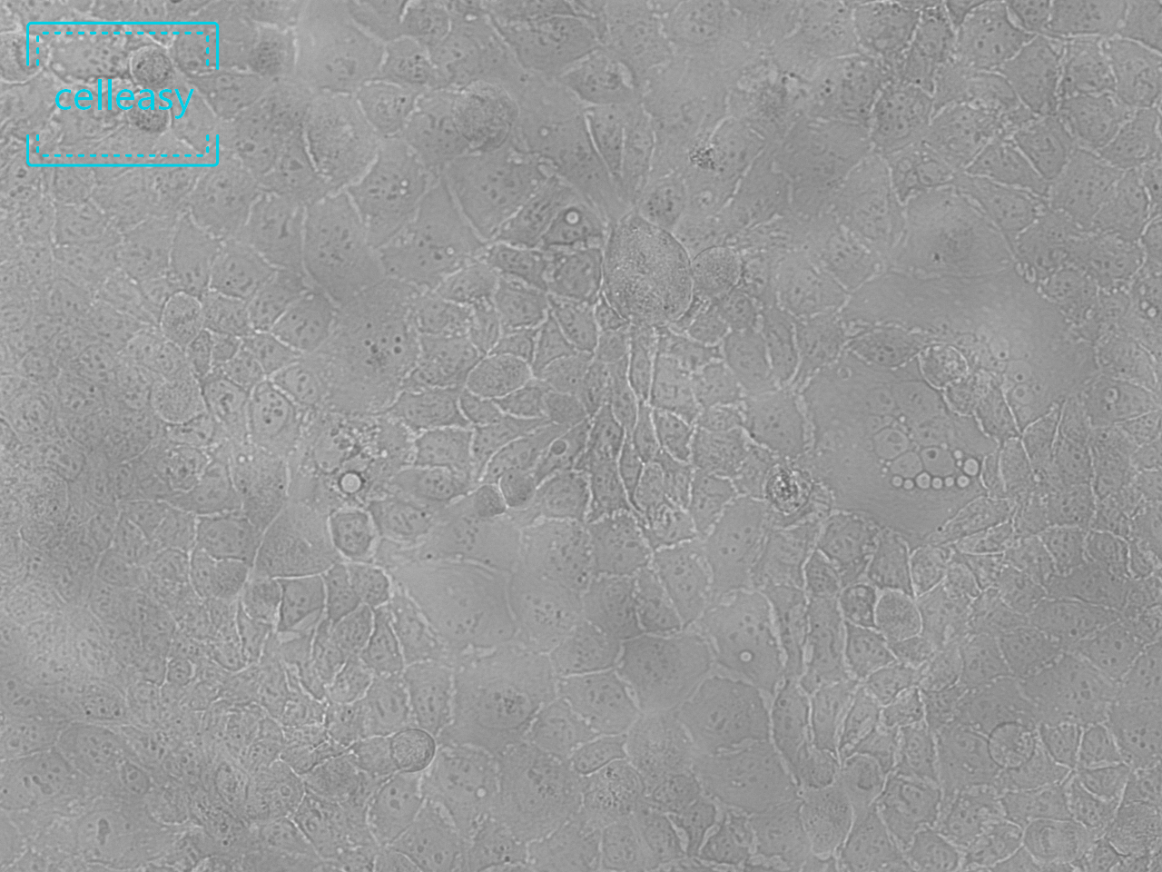人结肠腺癌细胞