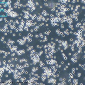 人Burkitt's淋巴瘤细胞