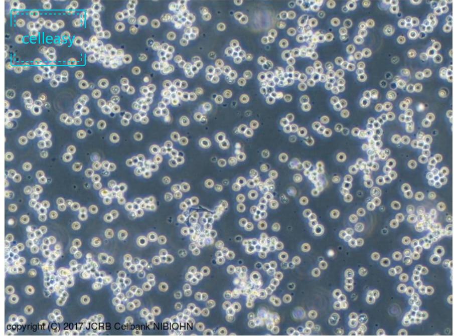 人Burkitt’s淋巴瘤细胞