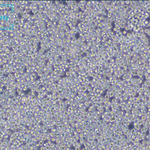 人T淋巴细胞白血病细胞