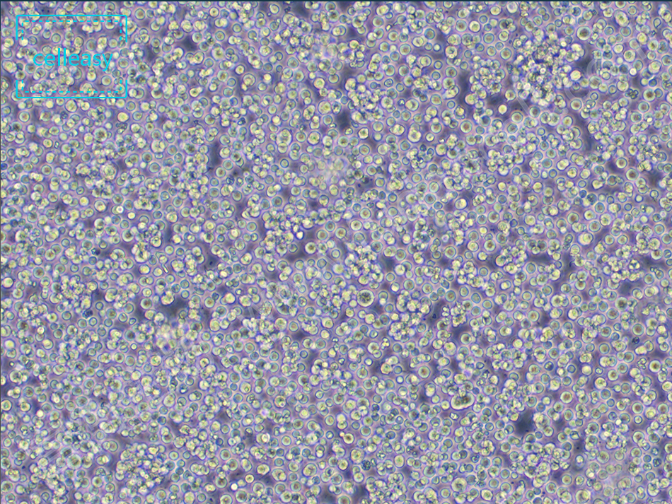 人T淋巴细胞白血病细胞