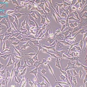 人前列腺癌细胞