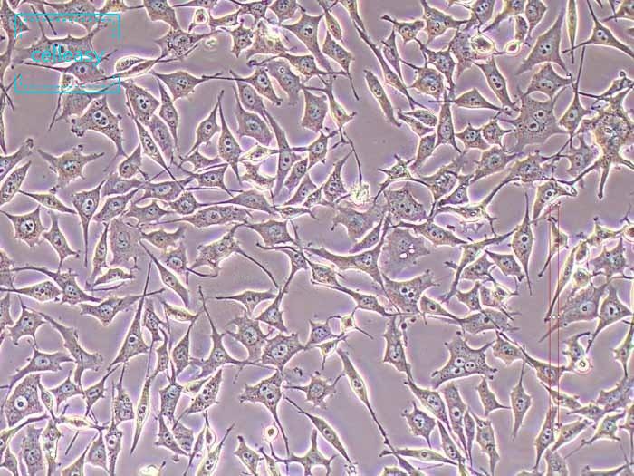 人前列腺癌细胞