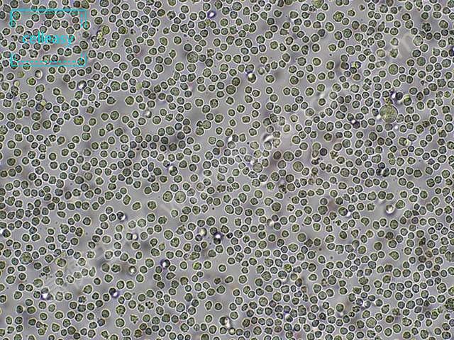 人单核细胞白血病细胞