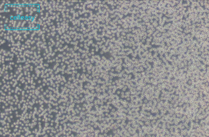 人原髓细胞白血病细胞