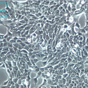 人永生化角质细胞