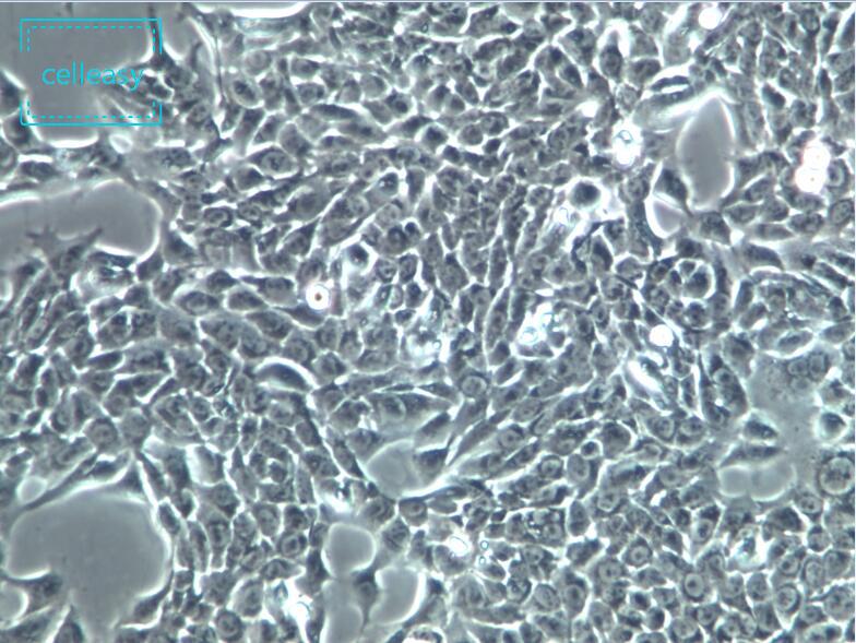 人永生化角质细胞