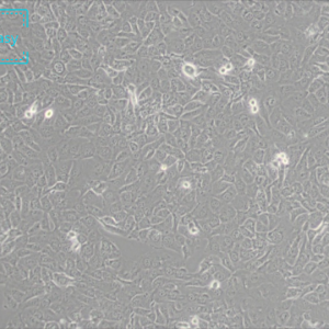 人纤维肉瘤细胞