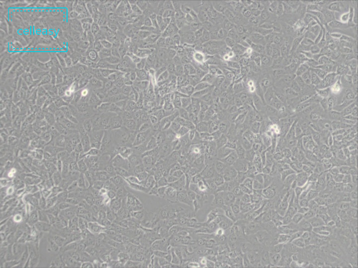 人纤维肉瘤细胞