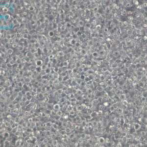 人组织细胞淋巴瘤细胞