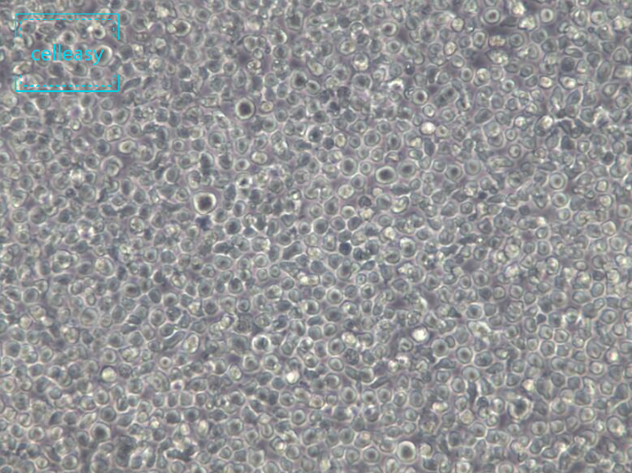 人组织细胞淋巴瘤细胞