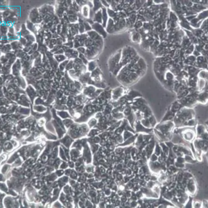 人结直肠腺癌细胞