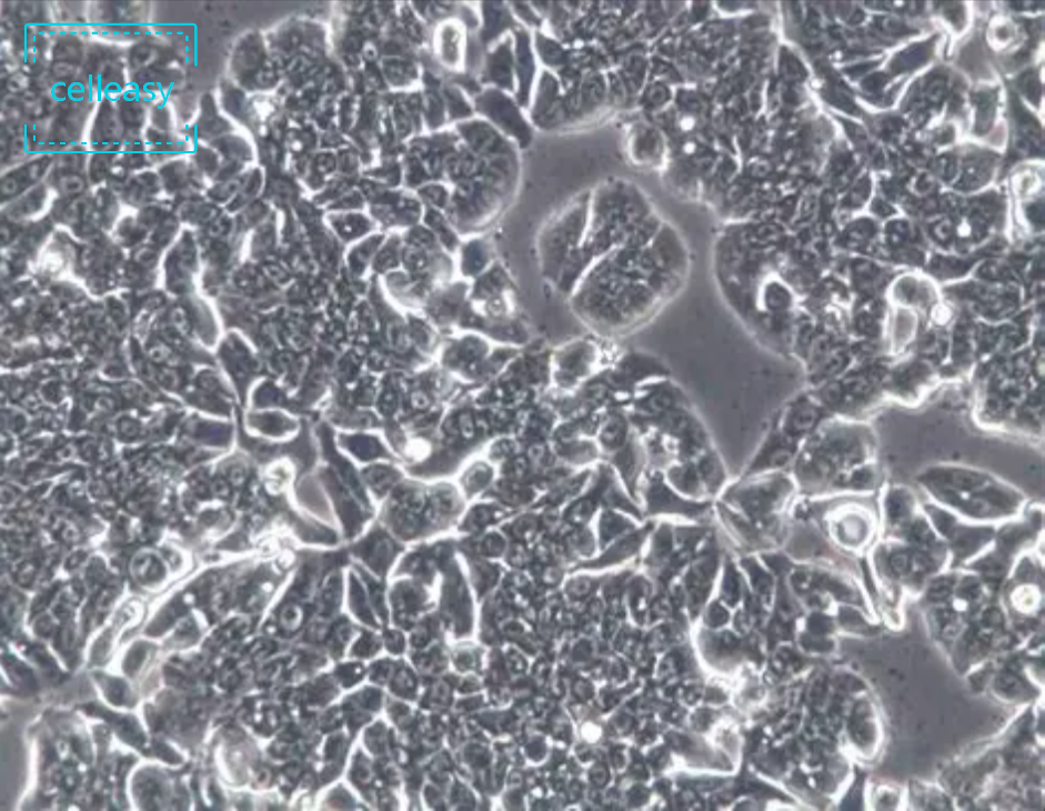 人结直肠腺癌细胞