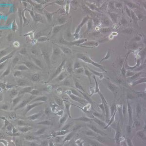 人肾细胞腺癌细胞