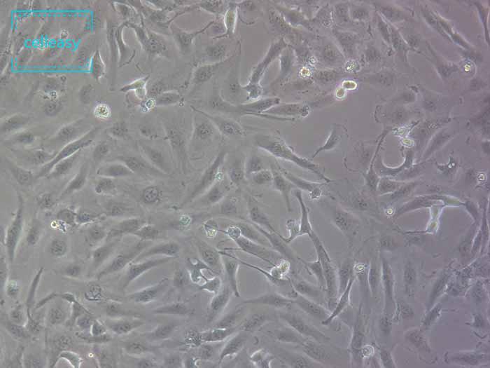 人肾细胞腺癌细胞