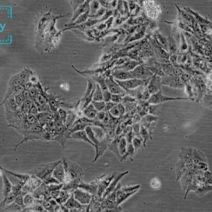 人胎盘绒膜癌细胞