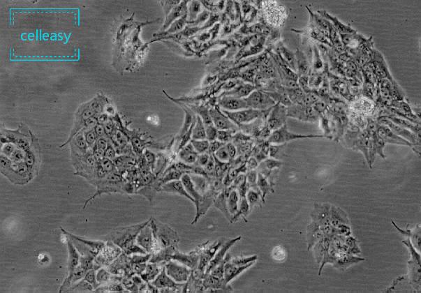 人胎盘绒膜癌细胞