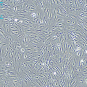 人脐静脉内皮细胞