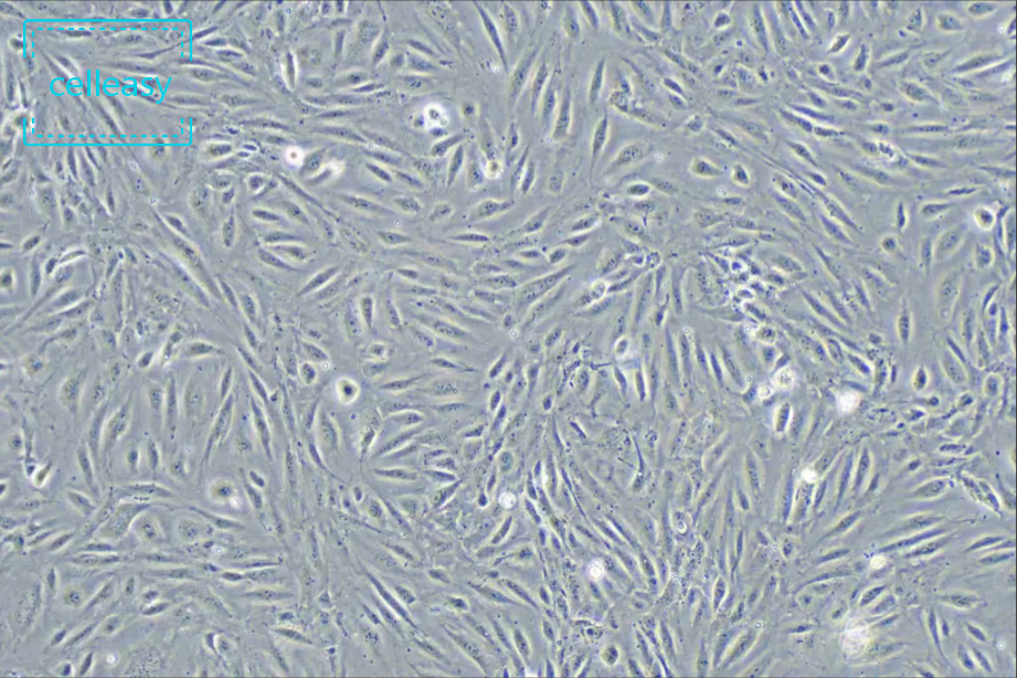 人脐静脉内皮细胞