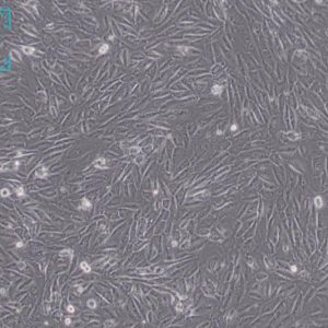 人脐静脉细胞融合细胞