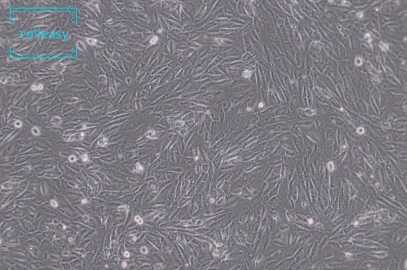 人脐静脉细胞融合细胞