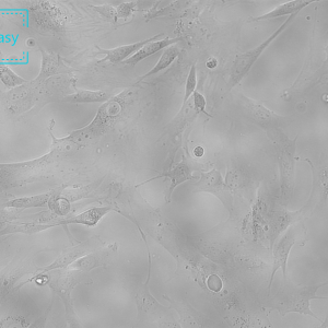 人软骨细胞永生化