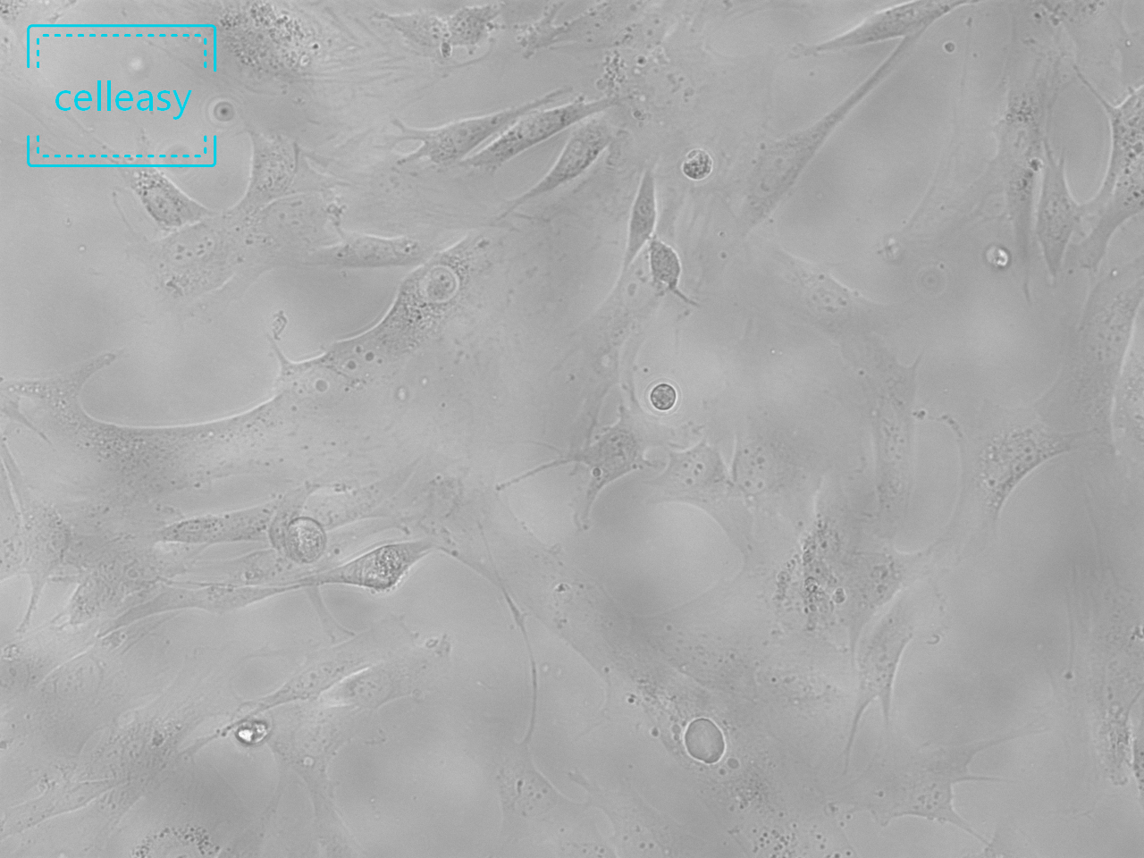 人软骨细胞永生化