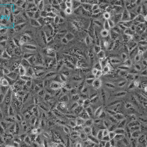 人非小细胞肺癌细胞