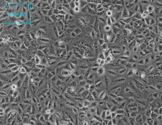 人非小细胞肺癌细胞