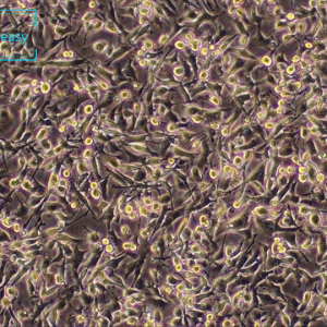 大鼠胰岛细胞瘤细胞