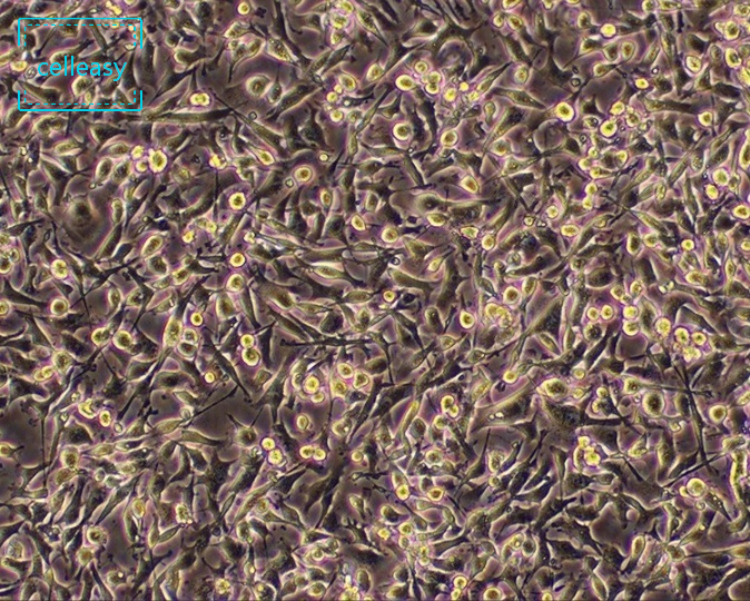 大鼠胰岛细胞瘤细胞