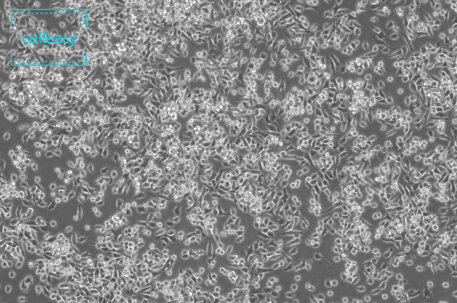 小鼠乳腺癌细胞