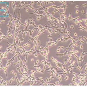 小鼠结肠癌细胞